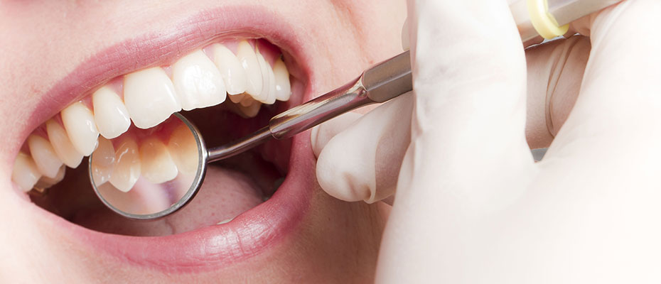 Zahnfleischentzündung Erding, Parodontitis (Parodontose)